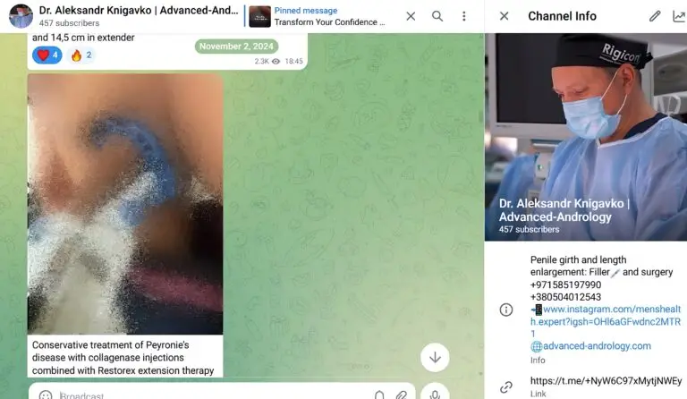 before and after Peyronie’s disease treatment